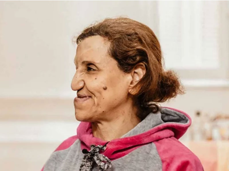 Mujer sobrevive a explosión tras tener una visión con Jesús