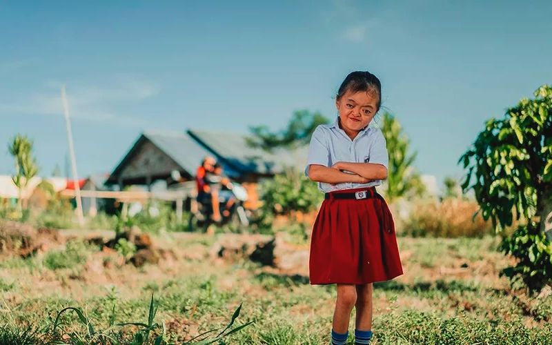 Niña con sindrome APERT lleva el evangelio a su comunidad