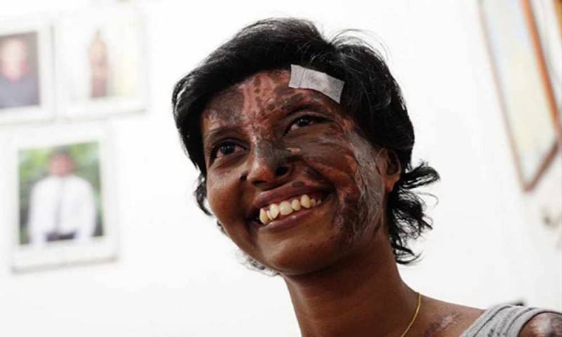 “Por la gracia de Jesucristo”: mujer sobrevive a incendio en iglesia