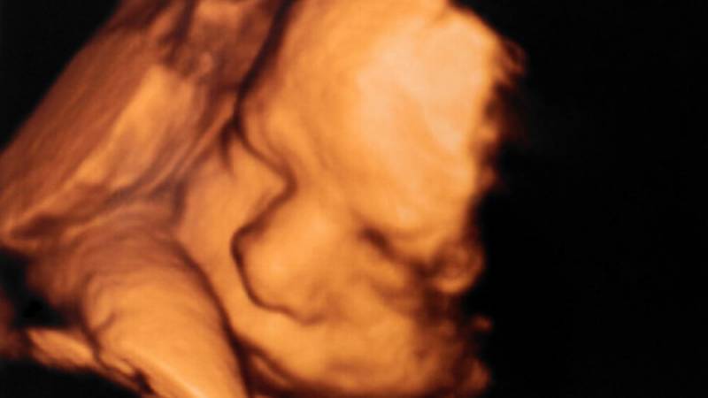 50% de los médicos de un hospital argentino se niegan a realizar abortos