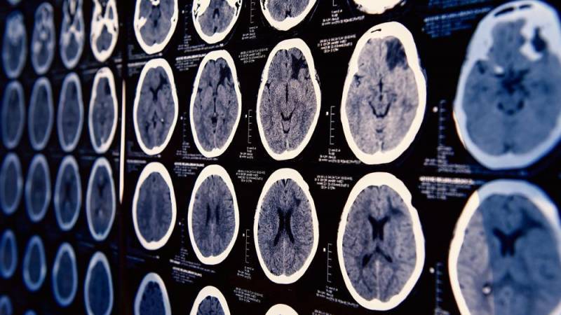 Nueva tecnología israelí podría reconectar los nervios dañados para restaurar el tacto