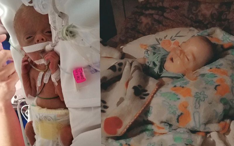 EE. UU.: Bebé vuelve a la vida después de ser declarado muerto